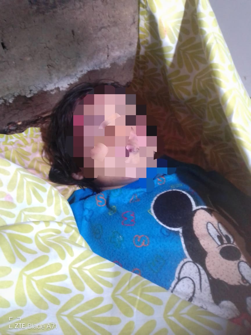 Pequeña niña víctima de intensas lluvias en Huachuma.